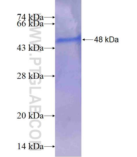 C14orf94 fusion protein Ag16811 SDS-PAGE