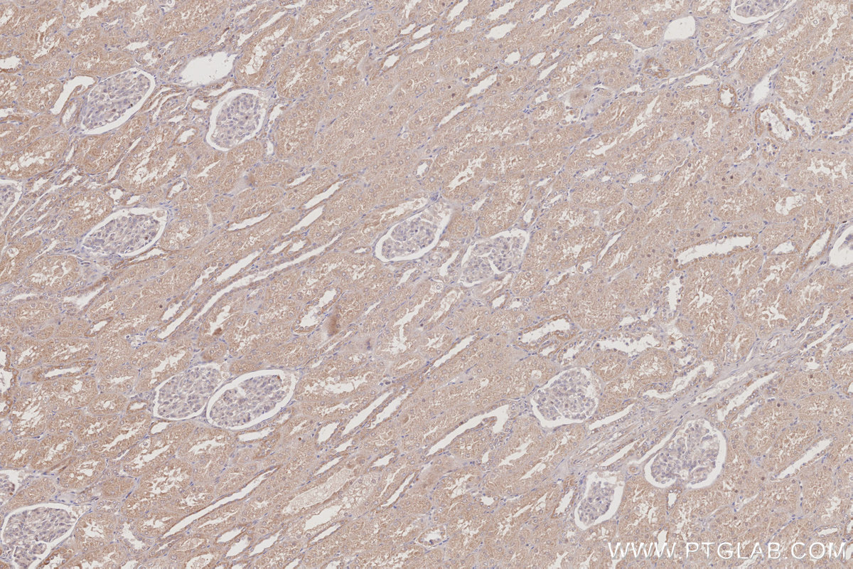 IHC staining of human kidney using 26189-1-AP