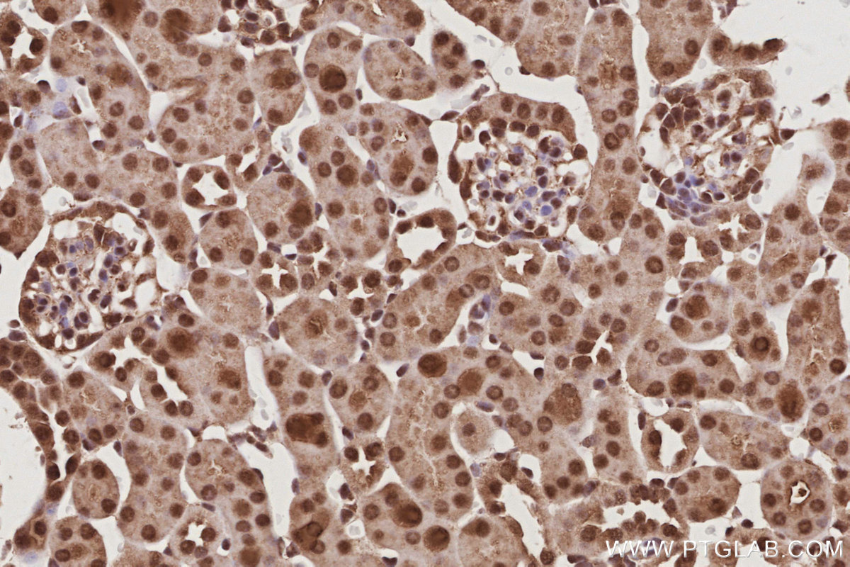 IHC staining of mouse kidney using 26189-1-AP