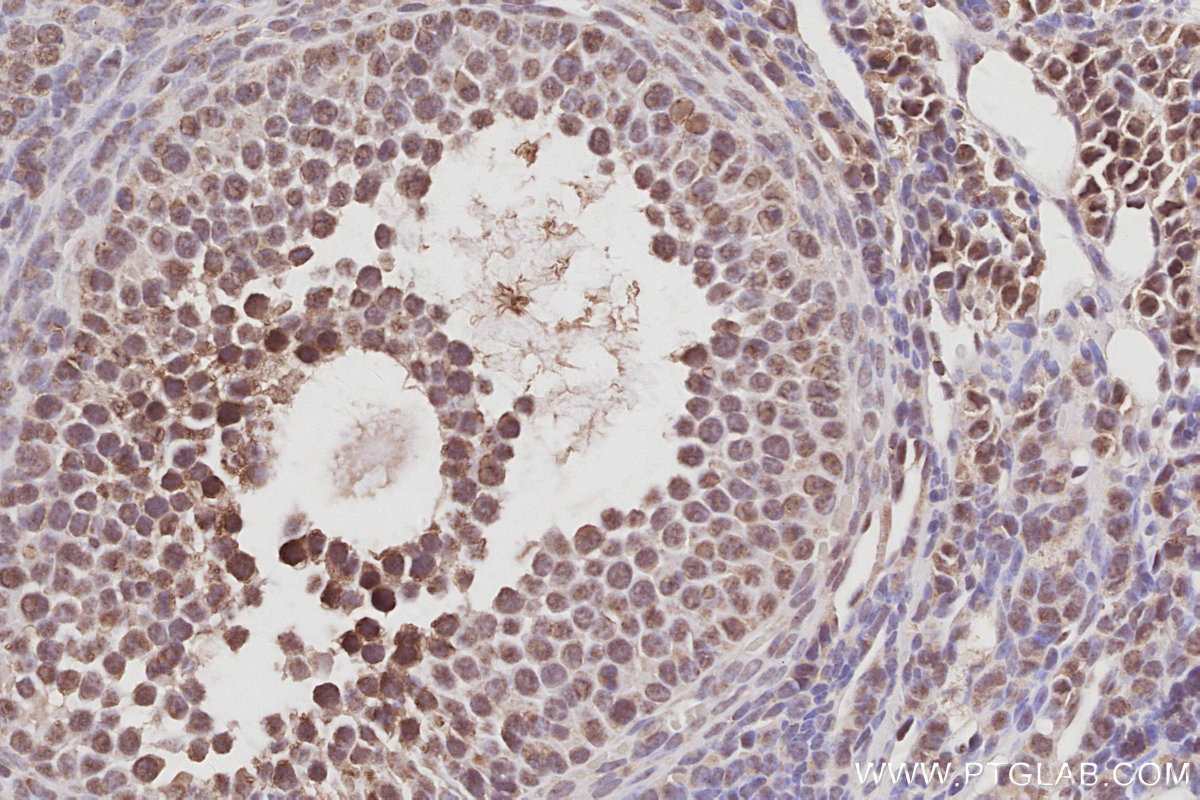 IHC staining of mouse ovary using 26189-1-AP