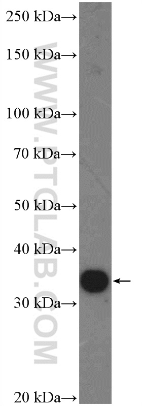 WB analysis of mouse liver using 26318-1-AP