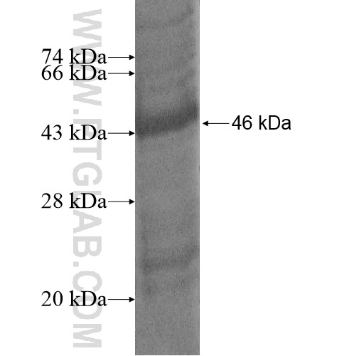 C15orf41 fusion protein Ag14580 SDS-PAGE C15orf41 fusion protein Ag14580 SDS-PAGE
