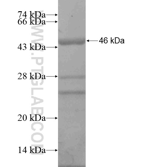 C15orf44 fusion protein Ag19792 SDS-PAGE C15orf44 fusion protein Ag19792 SDS-PAGE