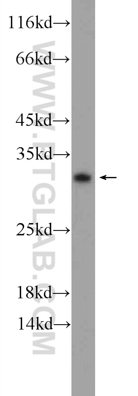 WB analysis of A431 using 24553-1-AP