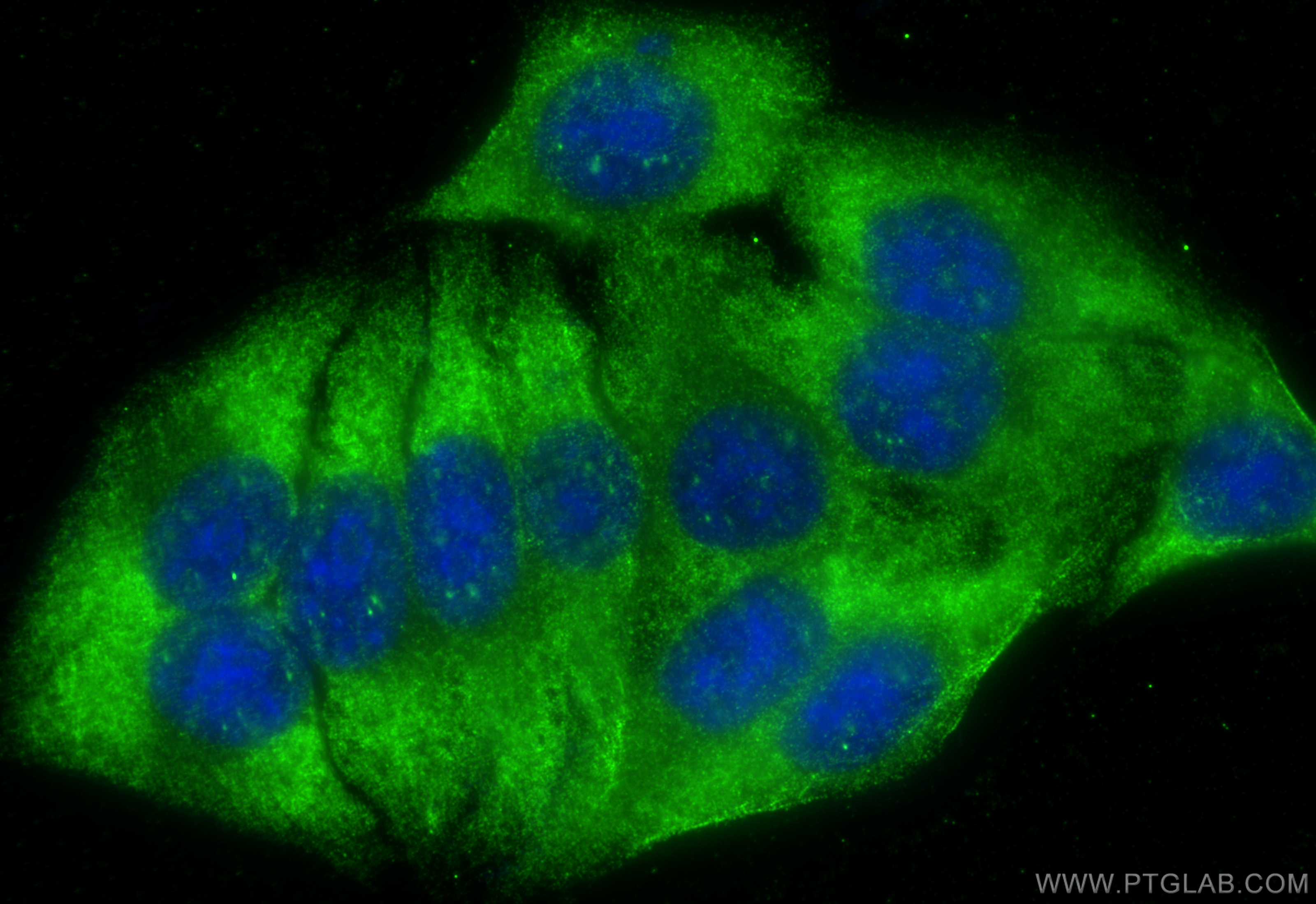 IF Staining of HepG2 using 20808-1-AP