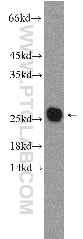 WB analysis of mouse brain using 26037-1-AP