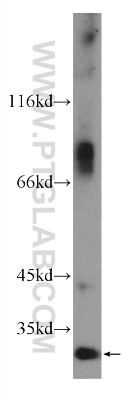 WB analysis of HeLa using 24522-1-AP