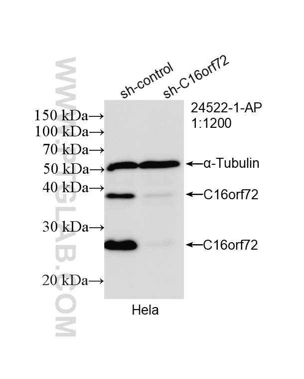 WB analysis of HeLa using 24522-1-AP WB analysis of HeLa using 24522-1-AP