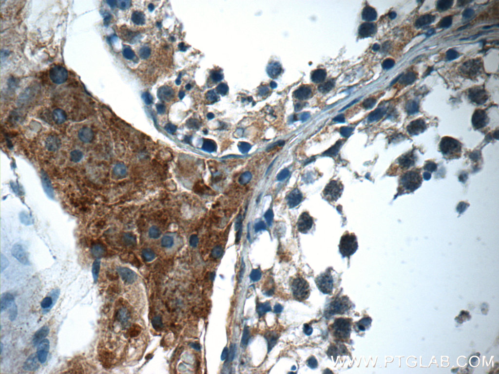 IHC staining of human testis using 23337-1-AP