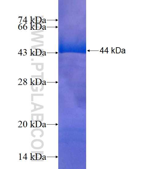 C17orf28 fusion protein Ag15427 SDS-PAGE