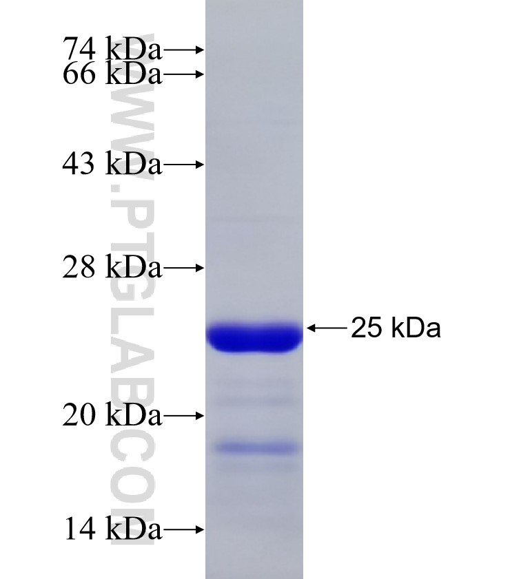 C17orf49 fusion protein Ag33151 SDS-PAGE C17orf49 fusion protein Ag33151 SDS-PAGE