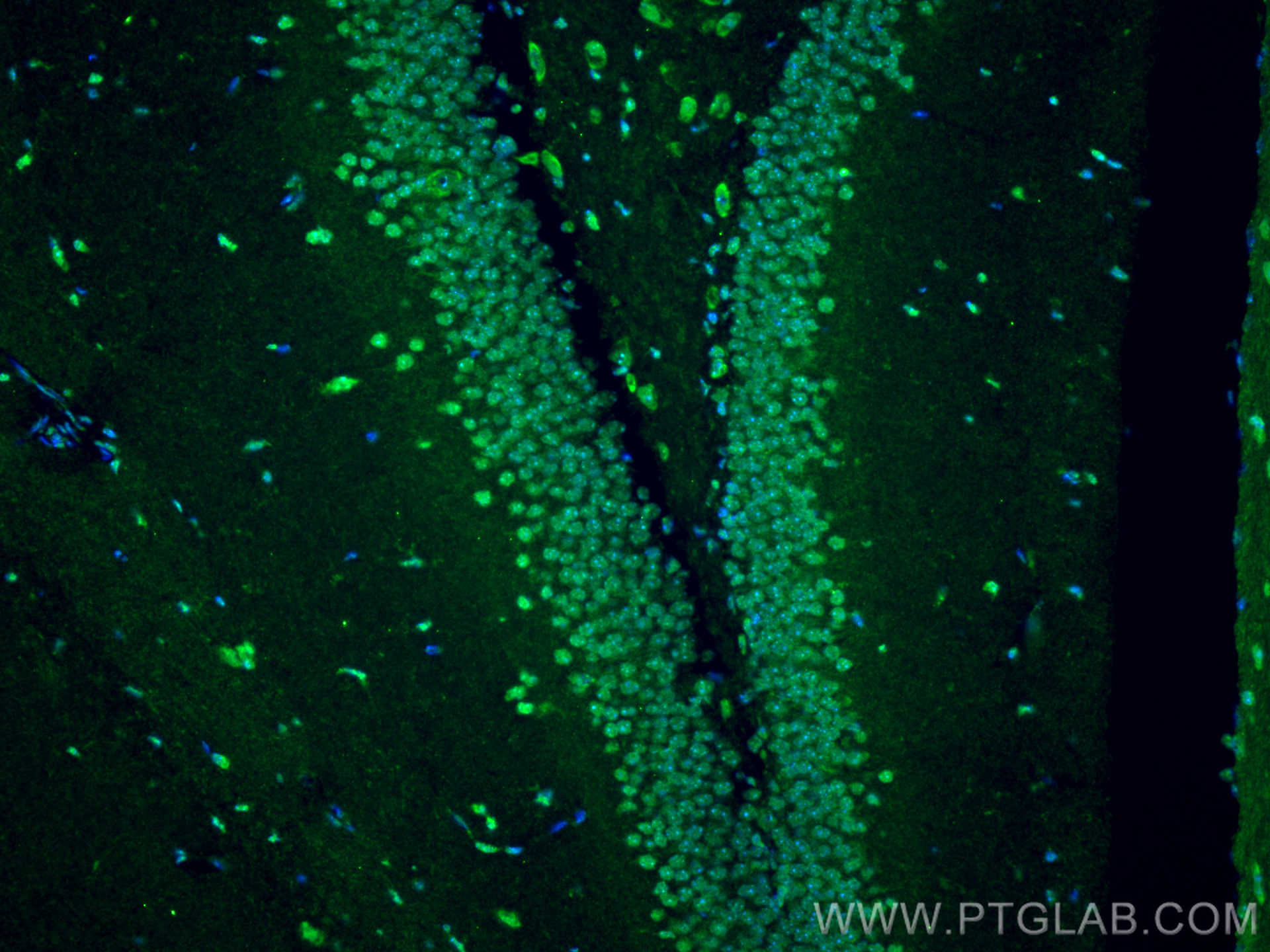 IF Staining of mouse brain using 28268-1-AP