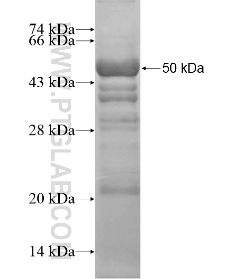 C17orf85 fusion protein Ag20021 SDS-PAGE