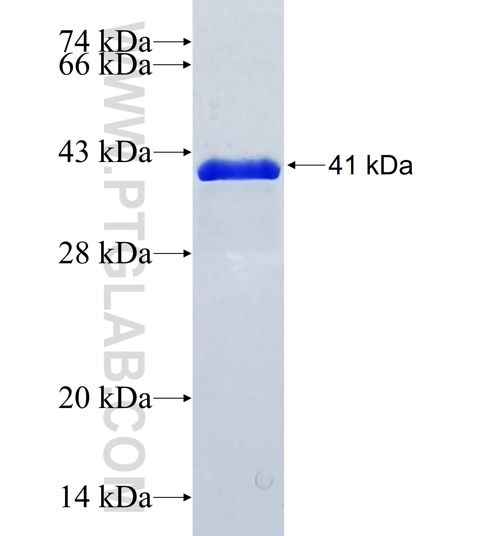 C17orf87 fusion protein Ag36999 SDS-PAGE C17orf87 fusion protein Ag36999 SDS-PAGE