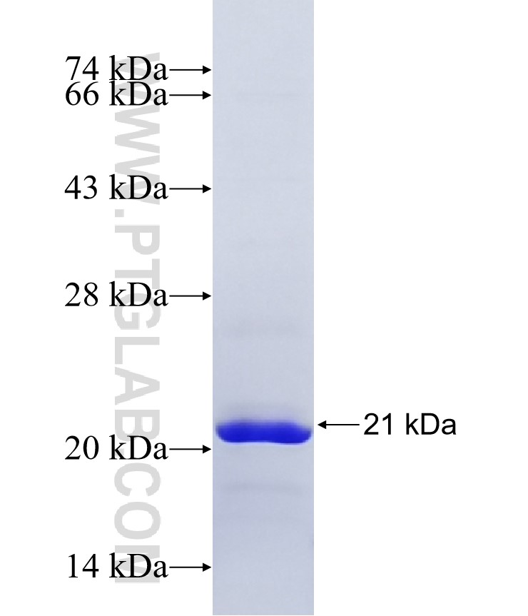 C17orf87 fusion protein Ag37023 SDS-PAGE C17orf87 fusion protein Ag37023 SDS-PAGE