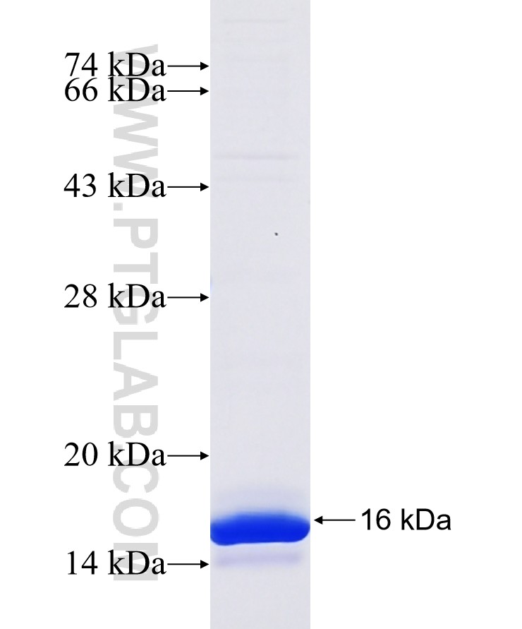 C17orf91 fusion protein Ag23568 SDS-PAGE C17orf91 fusion protein Ag23568 SDS-PAGE