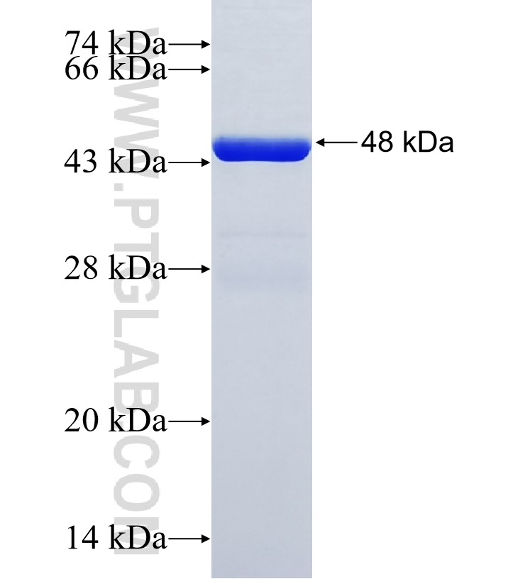 C18orf10 fusion protein Ag35419 SDS-PAGE C18orf10 fusion protein Ag35419 SDS-PAGE