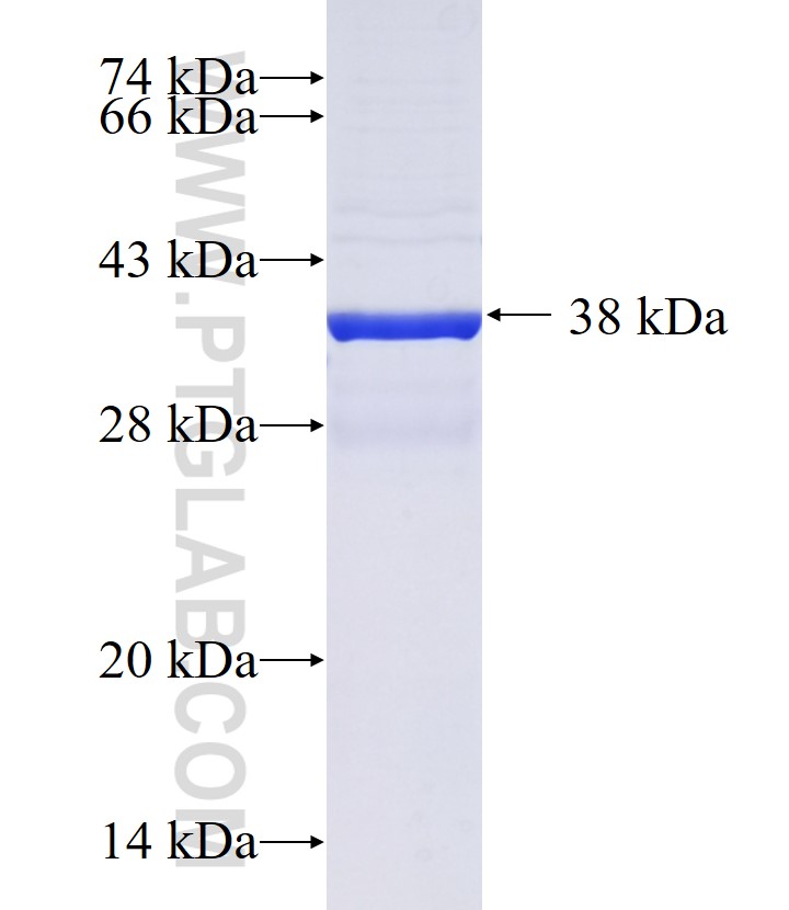C18orf19 fusion protein Ag36161 SDS-PAGE