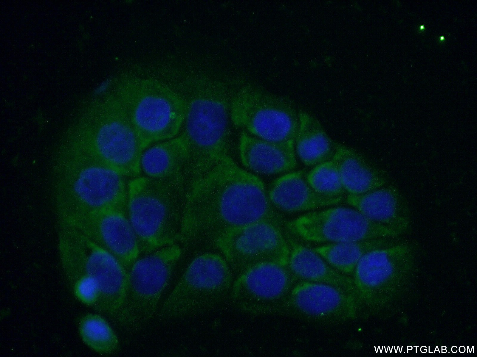 IF Staining of COLO 320 using 24977-1-AP