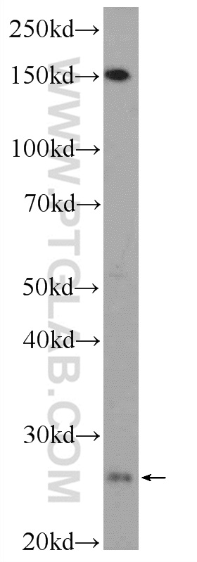 WB analysis of COLO 320 using 24977-1-AP