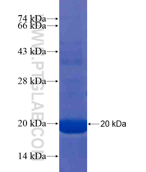 C18orf22 fusion protein Ag20458 SDS-PAGE C18orf22 fusion protein Ag20458 SDS-PAGE