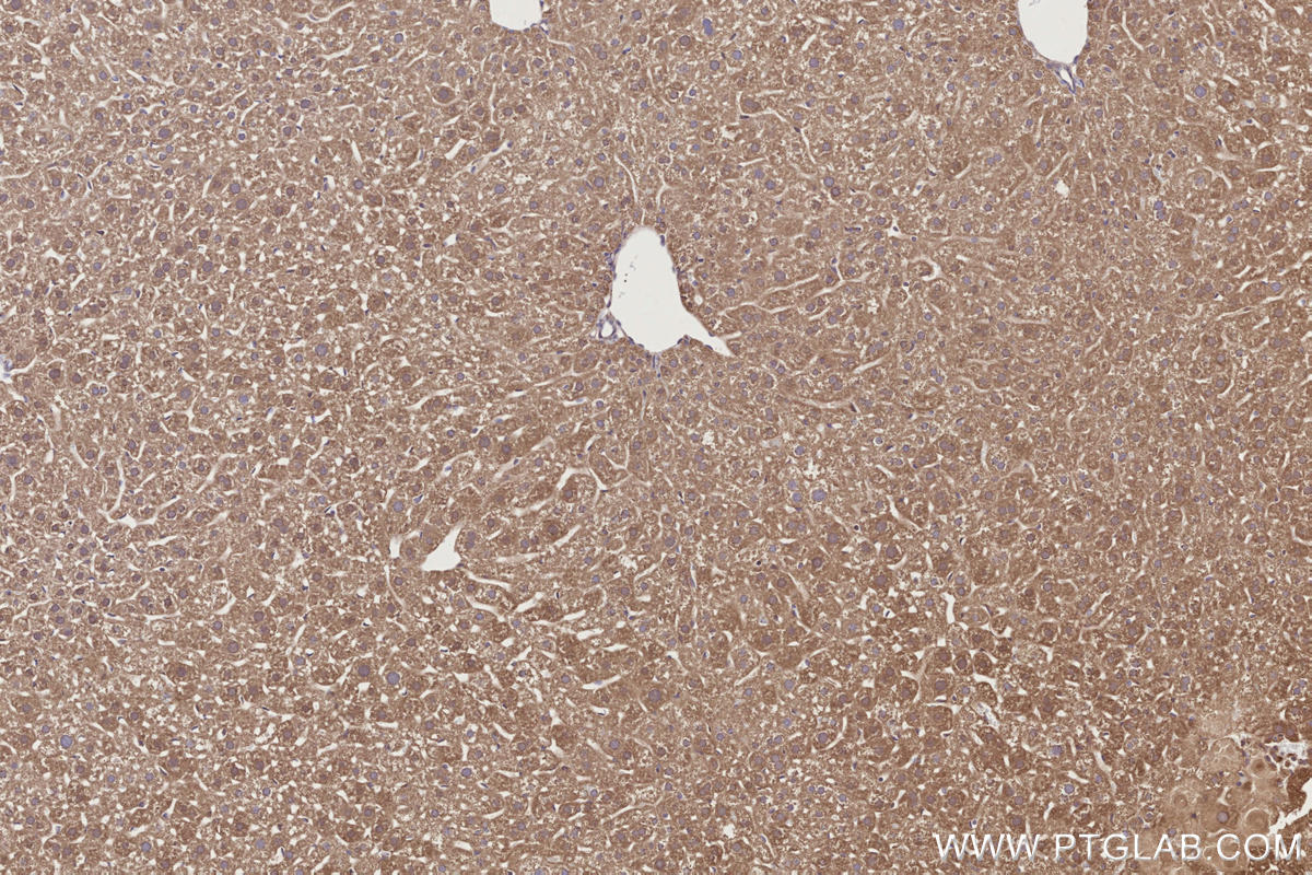IHC staining of mouse liver using 31161-1-AP IHC staining of mouse liver using 31161-1-AP