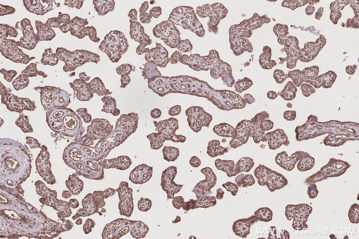 IHC staining of human placenta using 31161-1-AP IHC staining of human placenta using 31161-1-AP