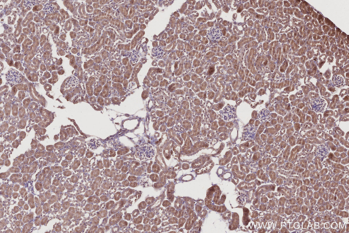 IHC staining of mouse kidney using 31161-1-AP IHC staining of mouse kidney using 31161-1-AP