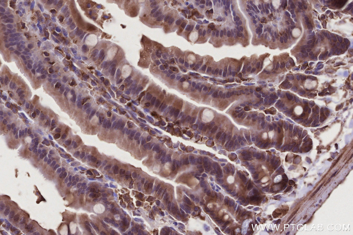 IHC staining of mouse small intestine using 31161-1-AP IHC staining of mouse small intestine using 31161-1-AP