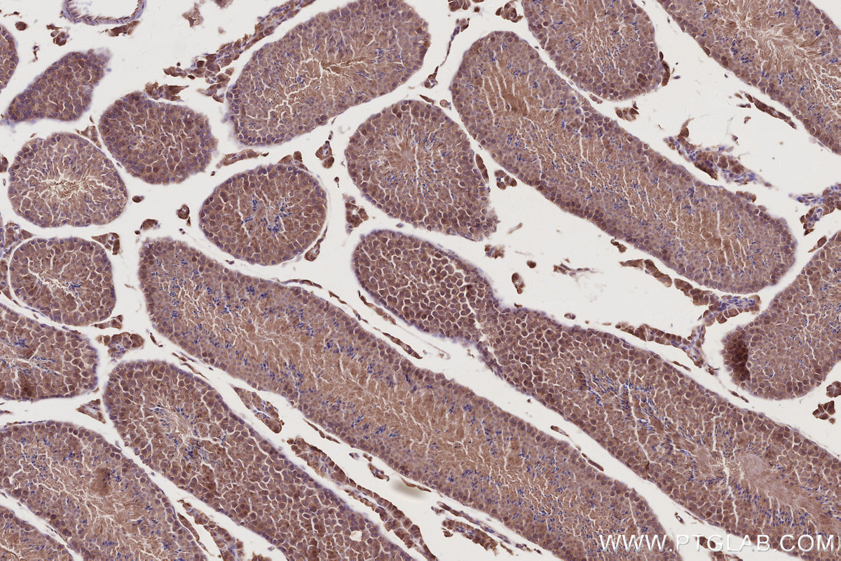 IHC staining of mouse testis using 31161-1-AP IHC staining of mouse testis using 31161-1-AP