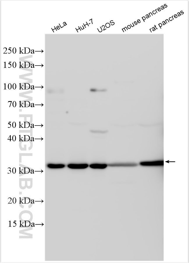 WB analysis using 31161-1-AP