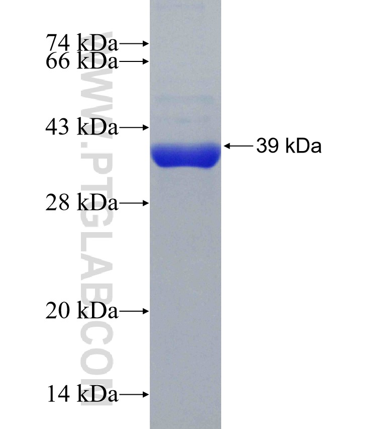 C18orf55 fusion protein Ag31220 SDS-PAGE