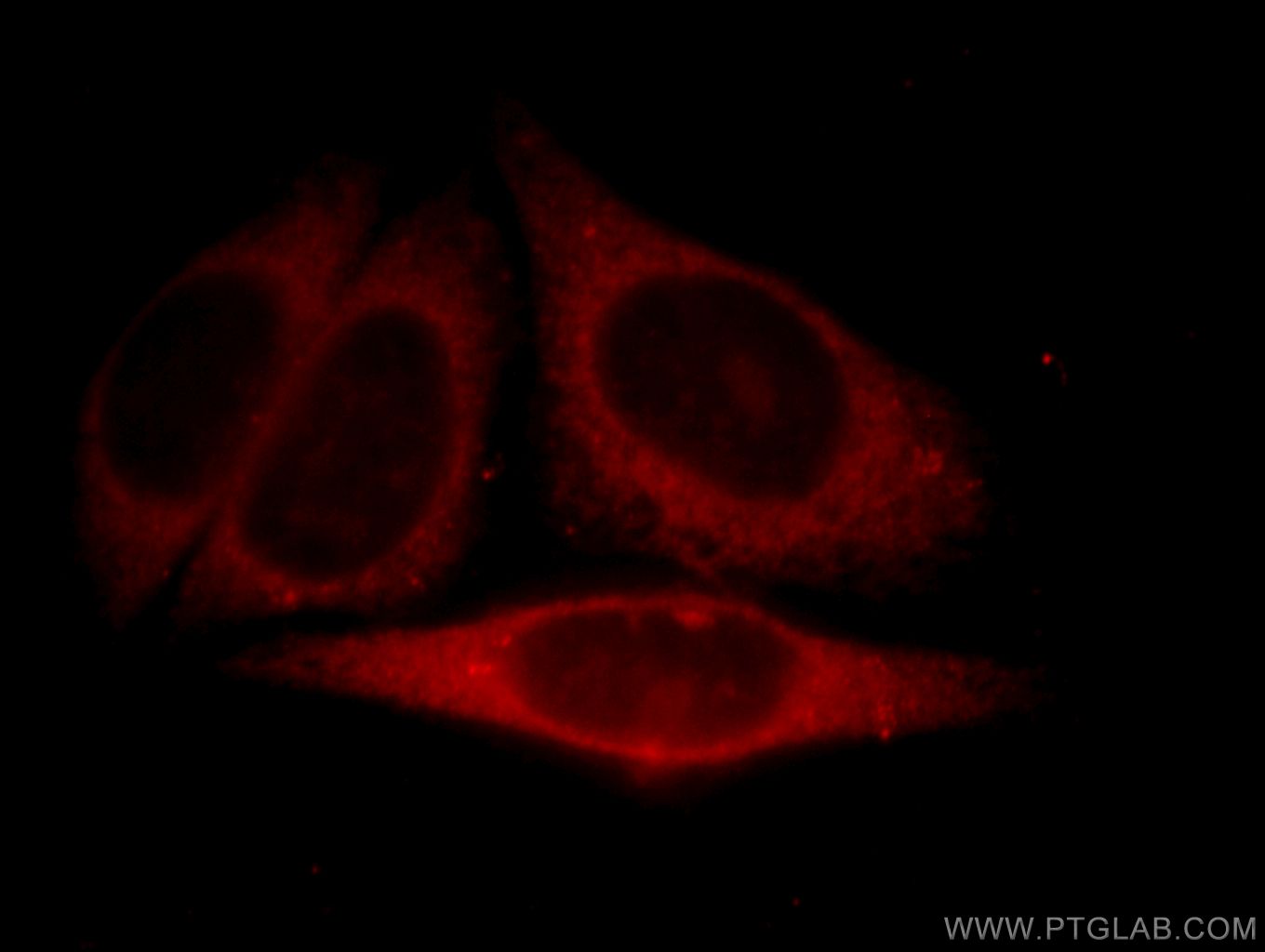 IF Staining of HepG2 using 11353-1-AP