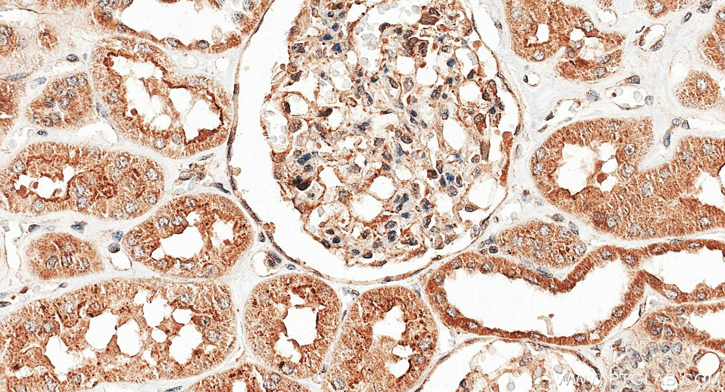 IHC staining of human kidney using 26338-1-AP