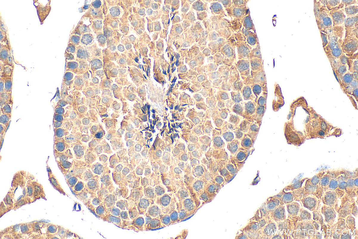 Immunohistochemical analysis of paraffin-embedded mouse testis tissue slide using 25650-1-AP (C19orf36 antibody) at dilution of 1:200 (under 40x lens). Heat mediated antigen retrieval with Tris-EDTA buffer (pH 9.0). IHC staining of mouse testis using 25650-1-AP