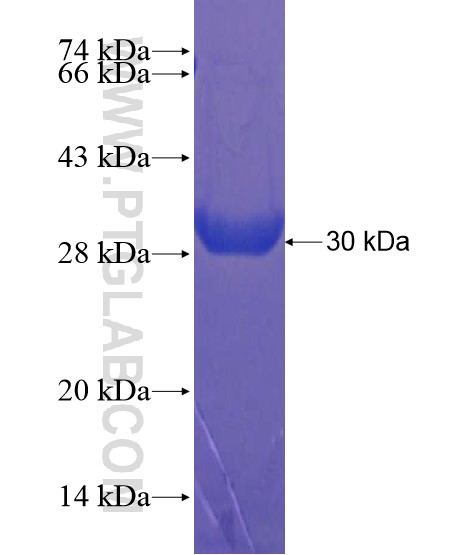 C19orf39 fusion protein Ag21678 SDS-PAGE C19orf39 fusion protein Ag21678 SDS-PAGE