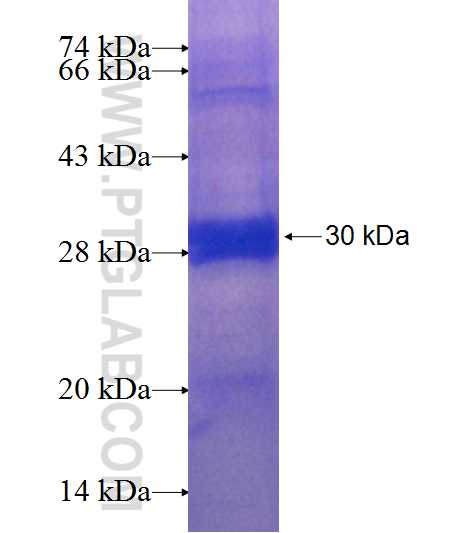 C19orf40 fusion protein Ag23940 SDS-PAGE