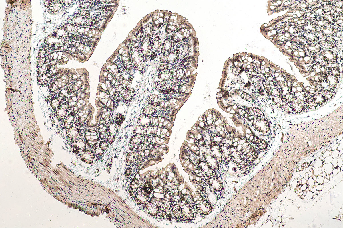 IHC staining of mouse colon using 19420-1-AP