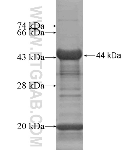 C19orf44 fusion protein Ag15975 SDS-PAGE C19orf44 fusion protein Ag15975 SDS-PAGE