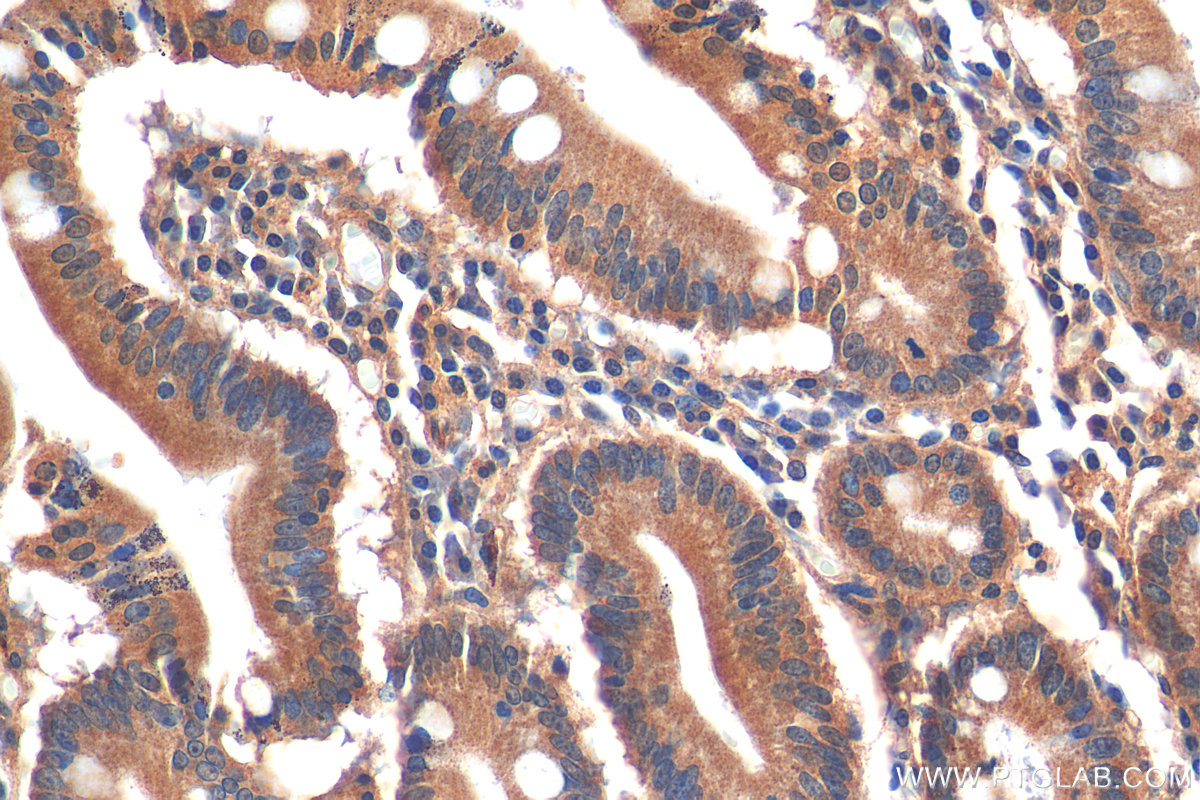 IHC staining of human stomach using 21060-1-AP (same clone as 21060-1-PBS)