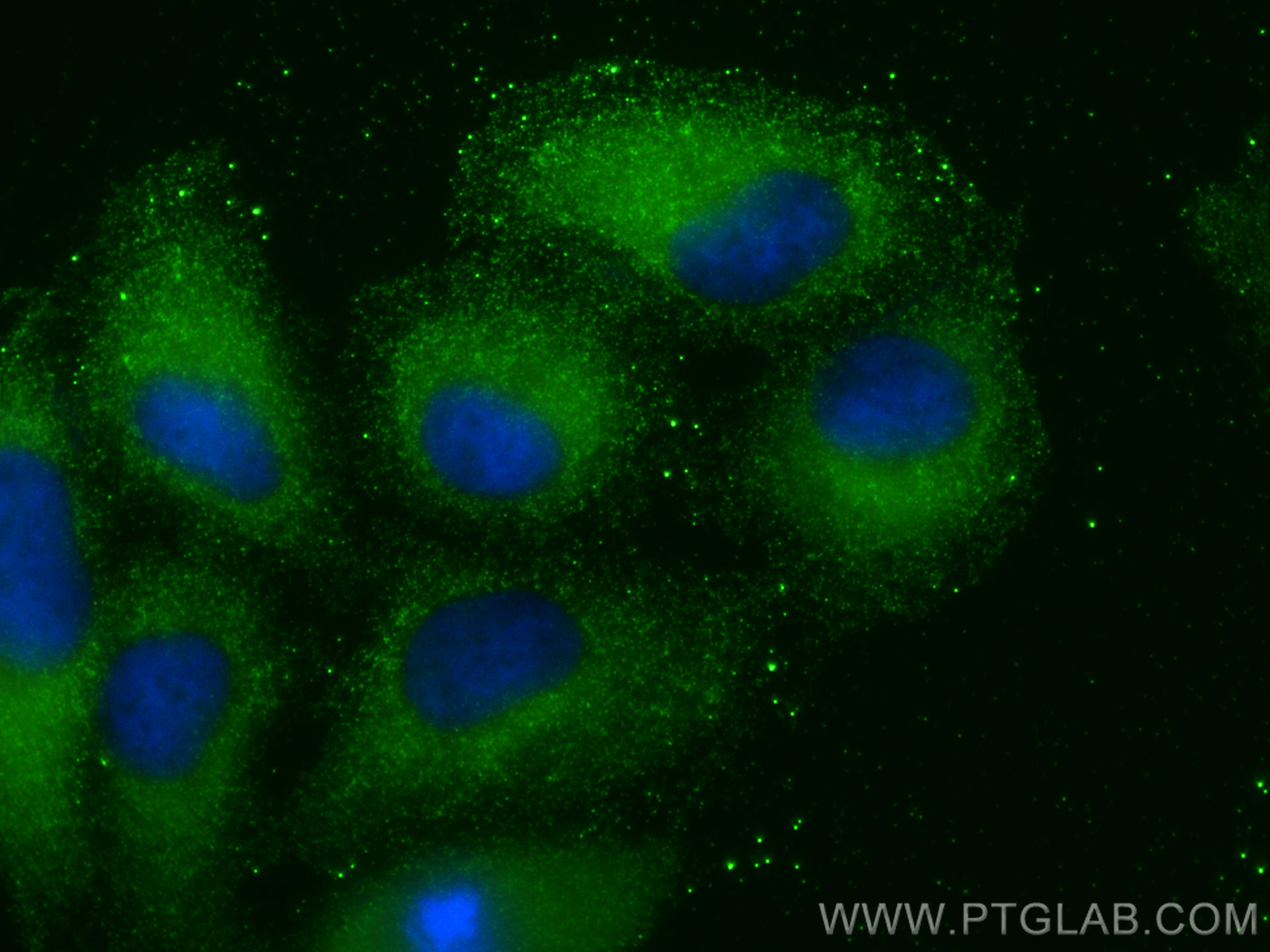 IF Staining of A549 using 20492-1-AP