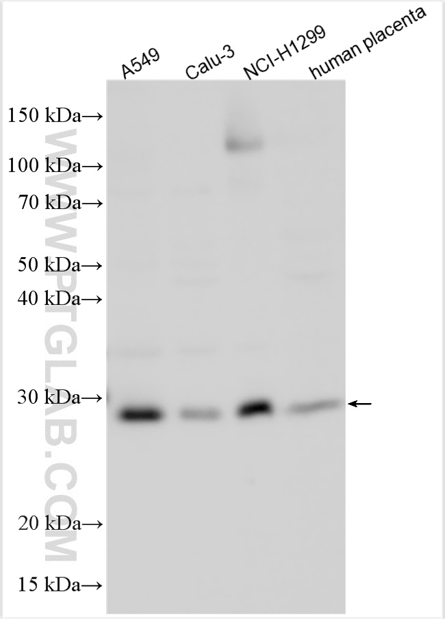 WB analysis using 20492-1-AP