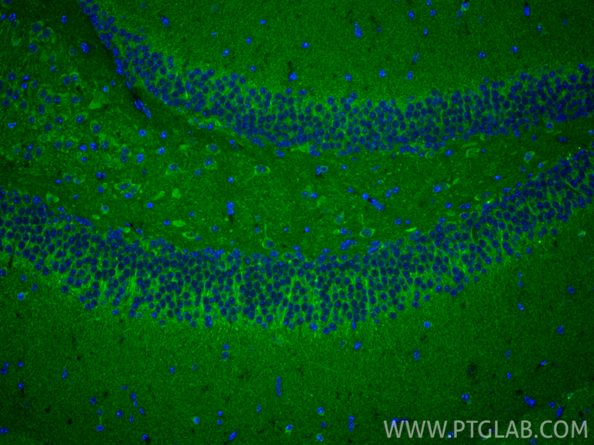 IF Staining of mouse brain using 25652-1-AP IF Staining of mouse brain using 25652-1-AP