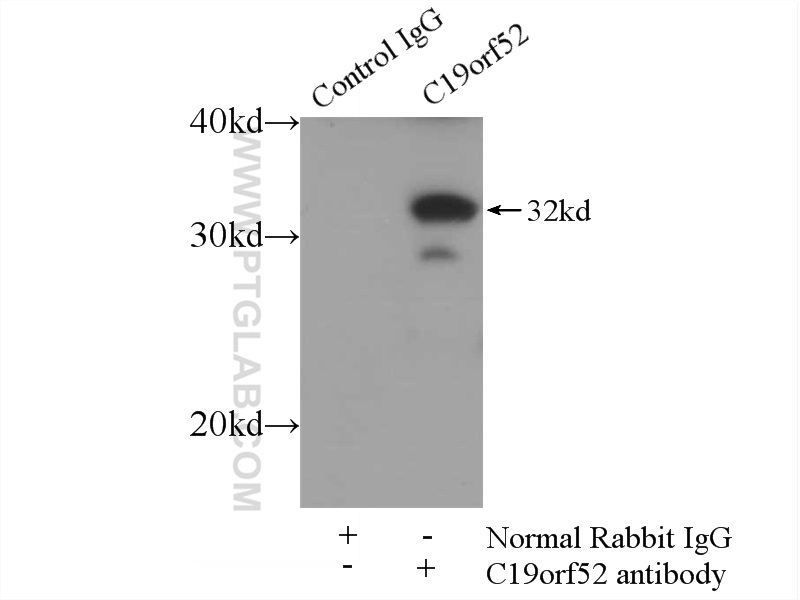 IP experiment of mouse skeletal muscle using 25652-1-AP