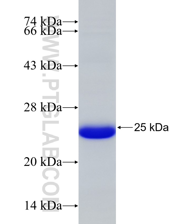 C19orf55 fusion protein Ag32474 SDS-PAGE C19orf55 fusion protein Ag32474 SDS-PAGE