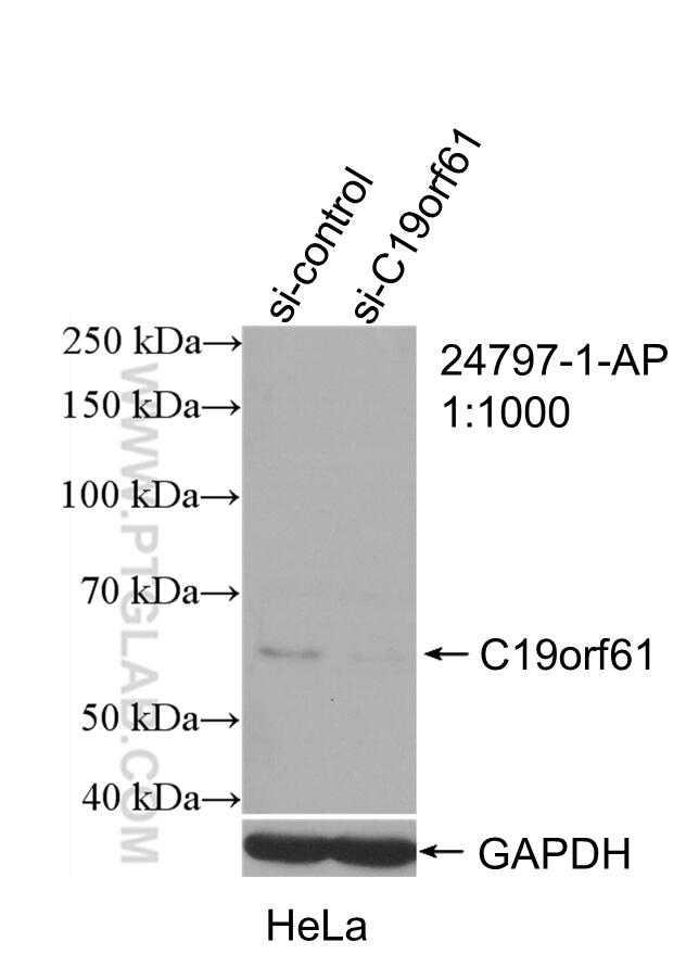 WB analysis of HeLa using 24797-1-AP