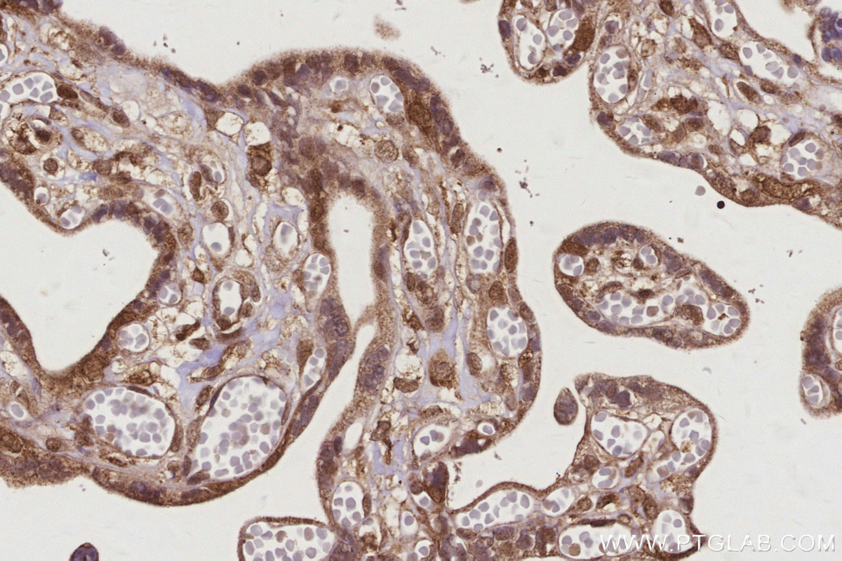 IHC staining of human placenta using 27926-1-AP IHC staining of human placenta using 27926-1-AP