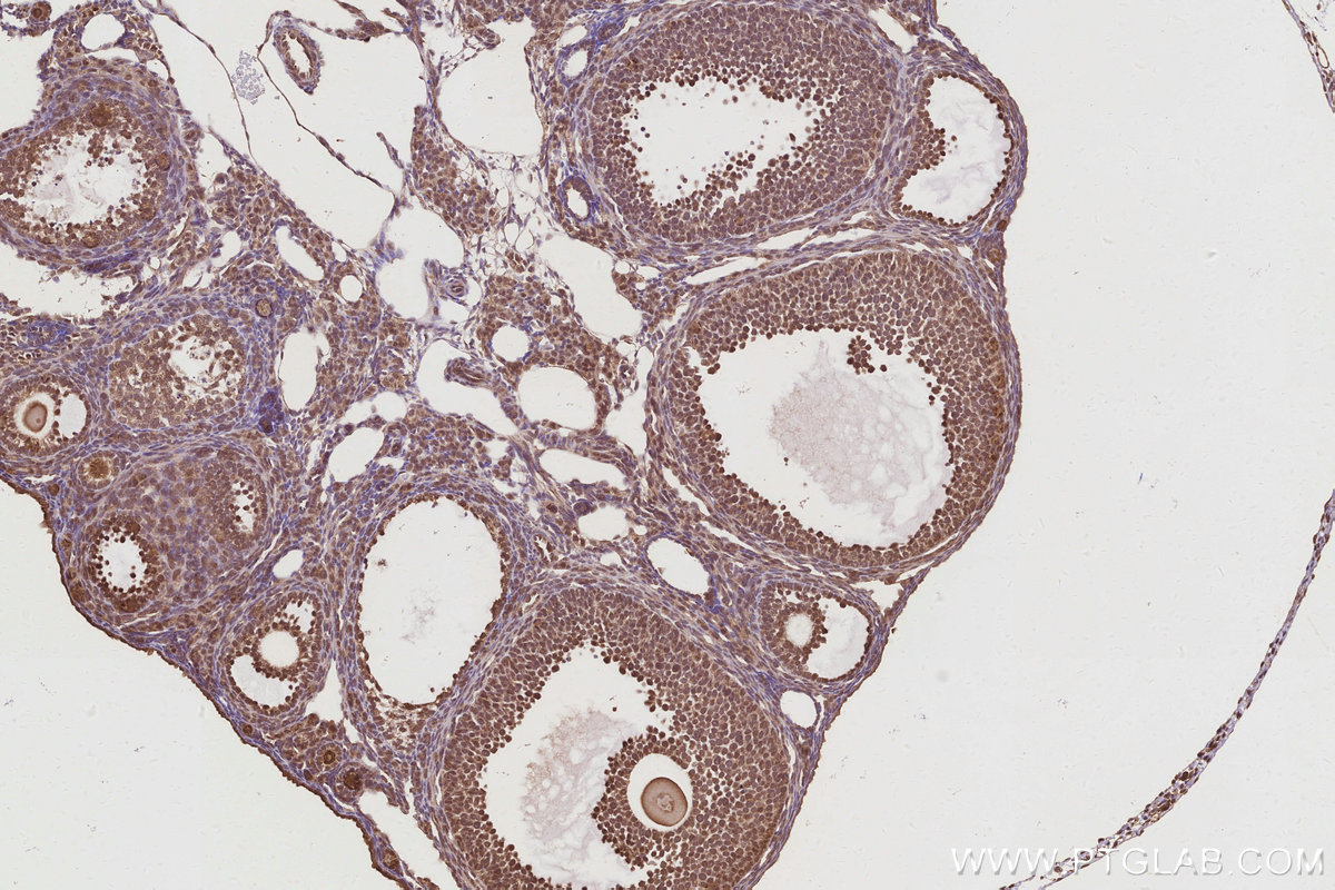 IHC staining of mouse ovary using 27926-1-AP IHC staining of mouse ovary using 27926-1-AP