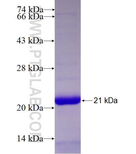 C19orf62 fusion protein Ag27424 SDS-PAGE C19orf62 fusion protein Ag27424 SDS-PAGE