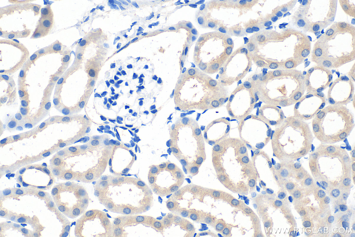 IHC staining of mouse kidney using 30844-1-AP